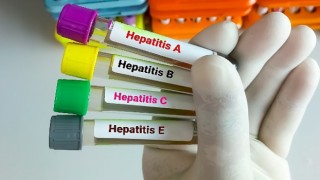 Hepatitte Aşılama Kronik Enfeksiyonları Önlemede %95 Etkili